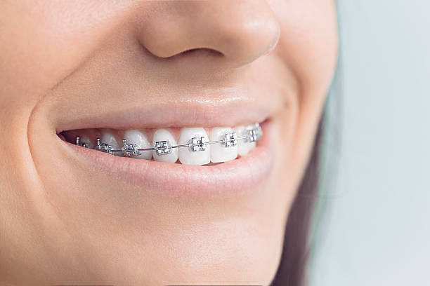 Best Veneers and Lumineers  in Honeyville, UT